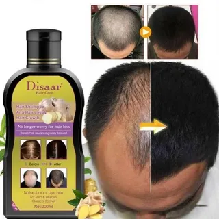 SHAMPOO ANTICAIDAS/CRECIMIENTO  CABELLO