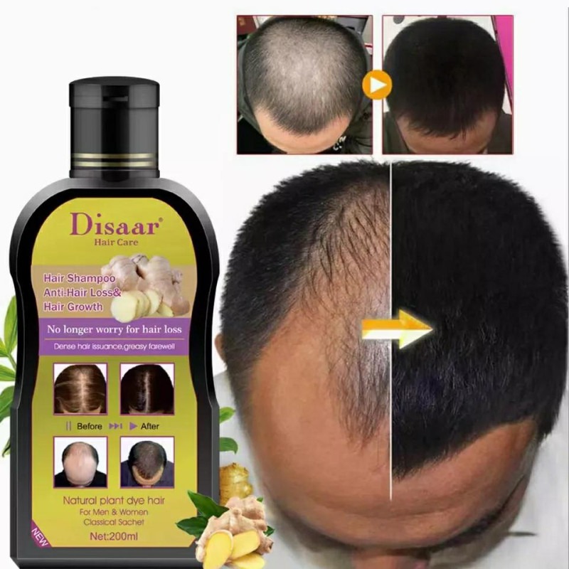 Shampoo Anti-Ca&iacute;da & Regenera de cabello
